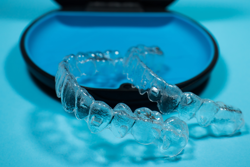 invisalign