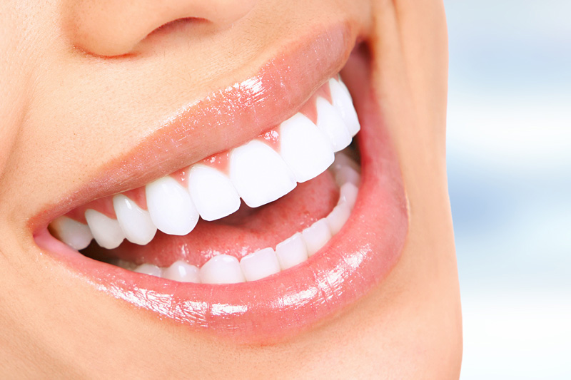 Cosmetic Dentistry in Las Vegas