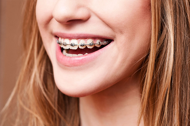 Orthodontics in Las Vegas